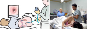 kolonoskopiya-pokazaniya-i-protivopokazaniya-k-procedure