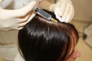 etapi-provedeniya-biorevitalizacii-volos