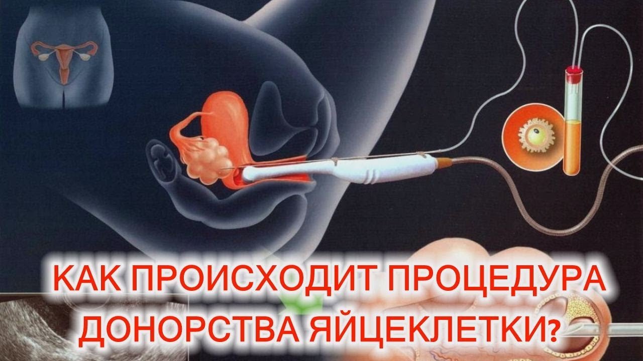 donorstvo-yaicekletki