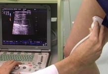 УЗИ сосудов нижних конечностей — показания к назначению